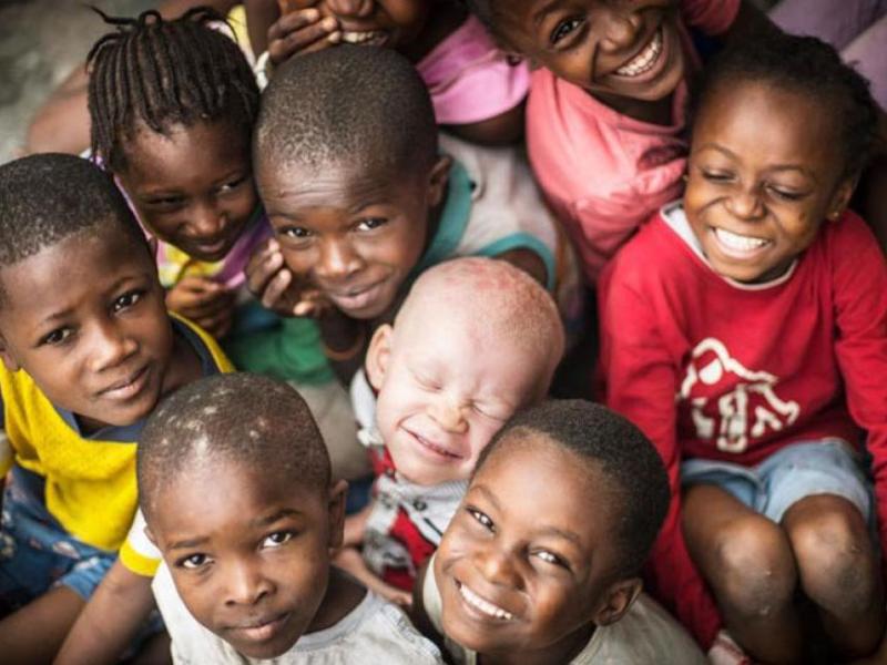 The Story of Albinism: From Noah to Modern-Day&nbsp;Tanzania